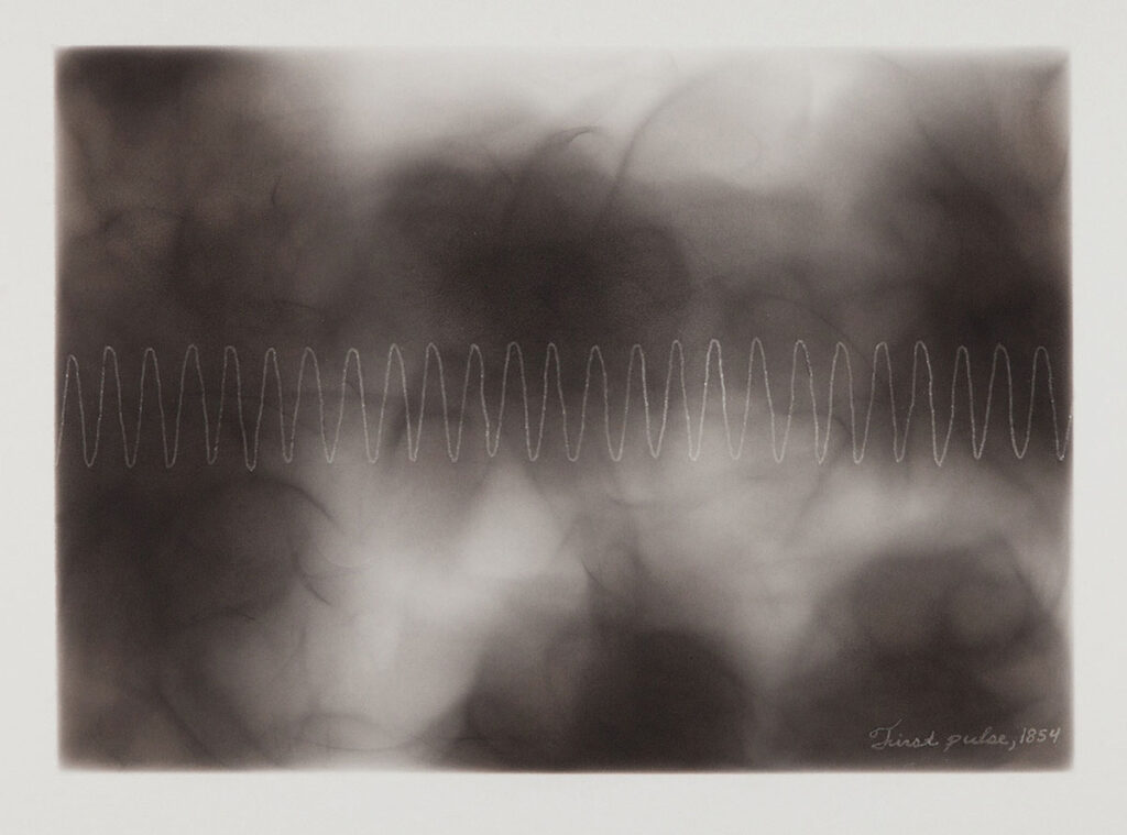 6-First-pulse-1854-1200px