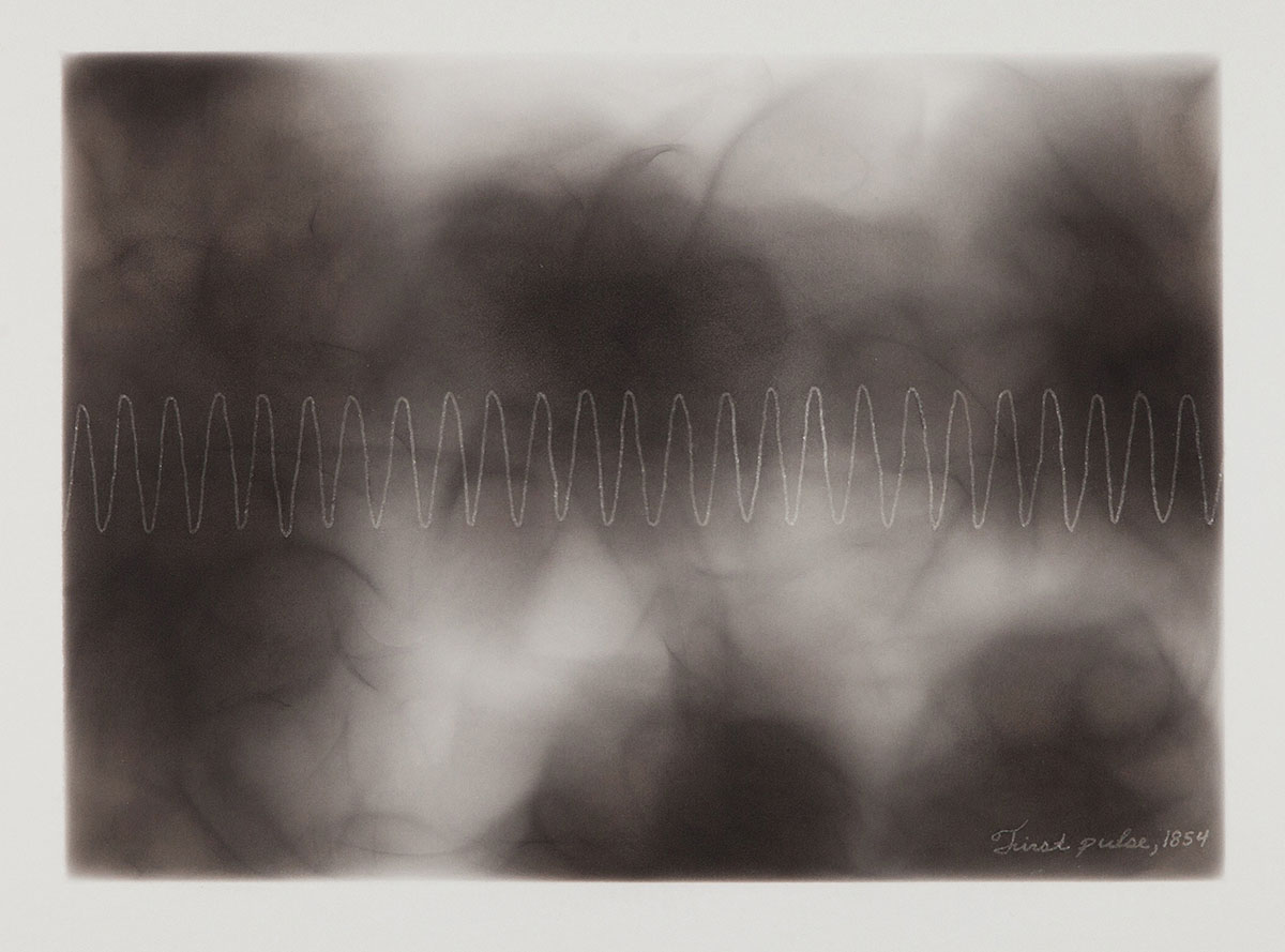 6-First-pulse-1854-1200px