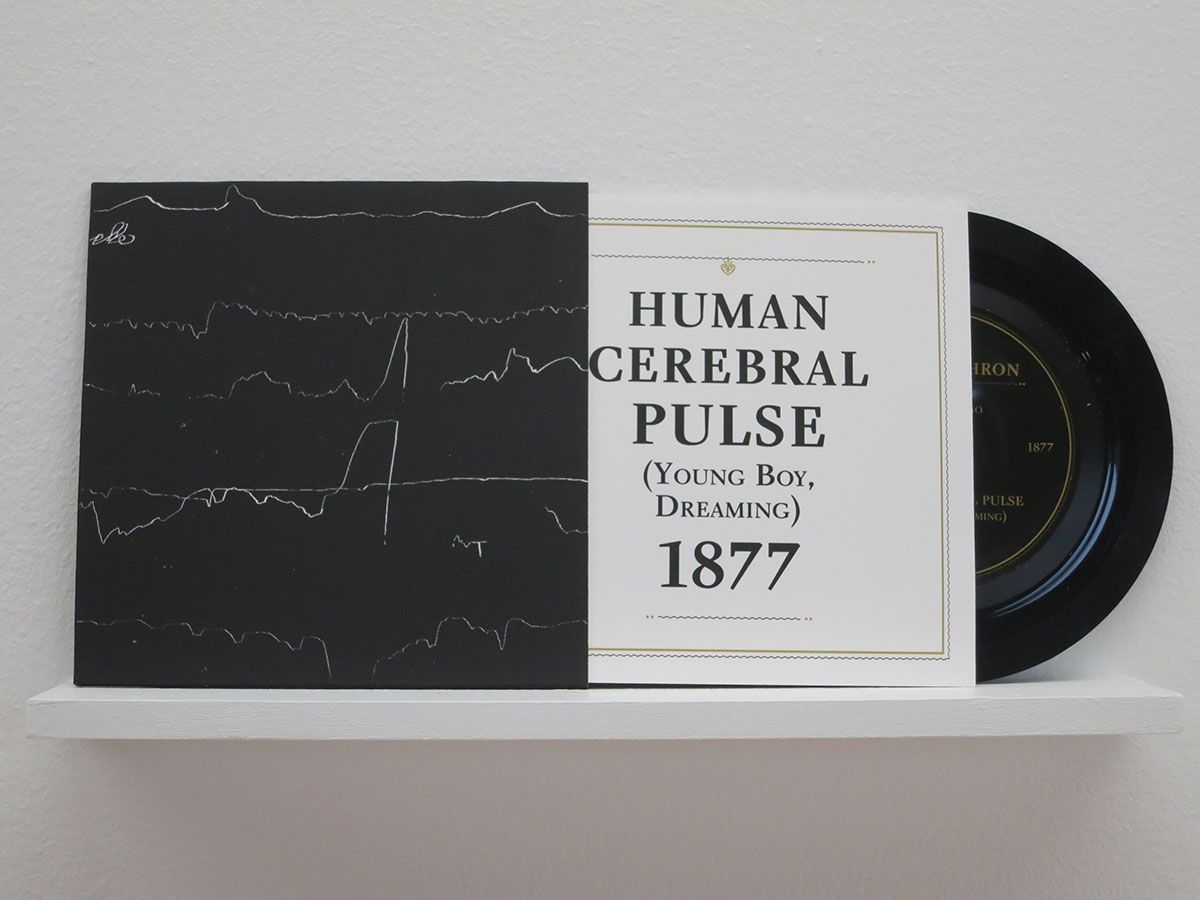 13_The-Pulse-Armed-With